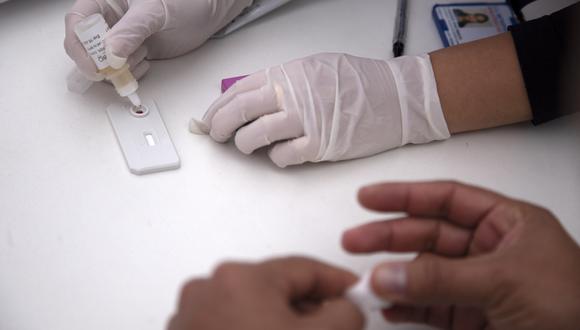 Una nueva variante más contagiosa y agresiva del VIH es descubierta en Países Bajos